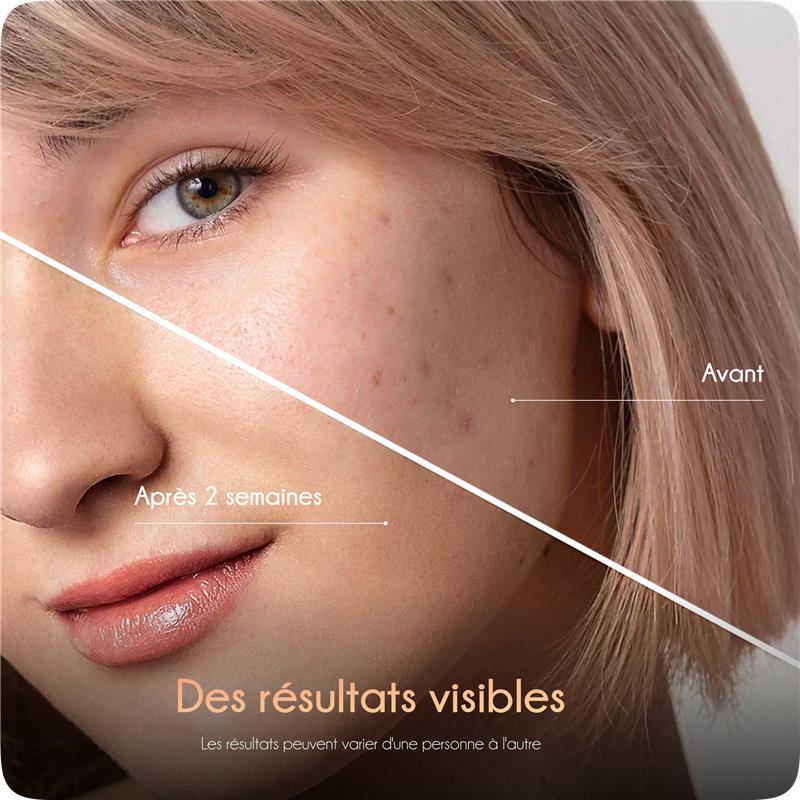 SERAVENE™ MAGIE POUR LA PEAU pour un magnifique Eclat